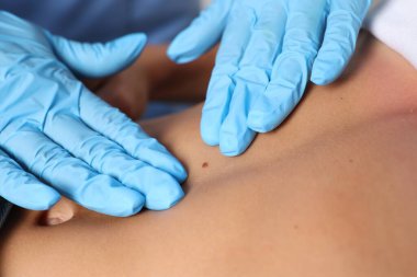 Hastanede genç bir kadının köstebeğini muayene eden doktor, yakın plan.