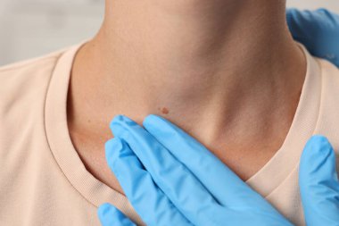 Hastanede genç bir kadının köstebeğini muayene eden doktor, yakın plan.