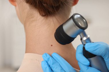 Doktor hastanede dermatoskopla genç kadının benini inceliyor.