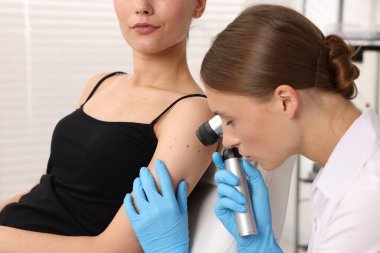 Doktor hastanede dermatoskopla genç kadının benini inceliyor.