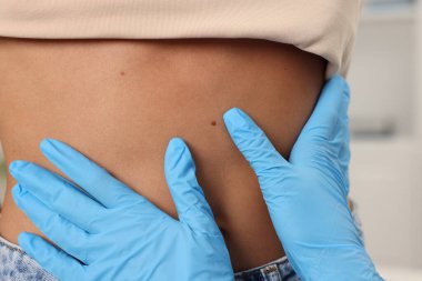 Hastanede genç bir kadının köstebeğini muayene eden doktor, yakın plan.