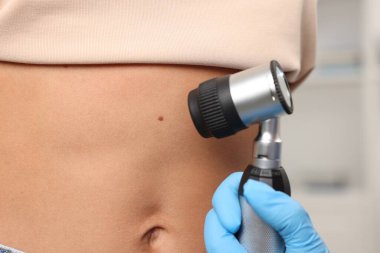 Doktor hastanede dermatoskopla genç kadının benini inceliyor.