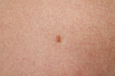 Vücudunda ben olan bir kadın, yakın plan.