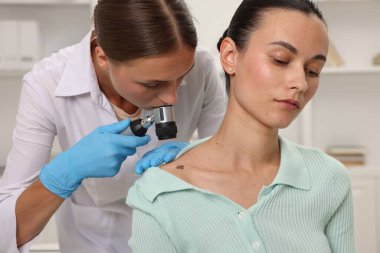 Doktor hastanede dermatoskopla genç kadının benini inceliyor.