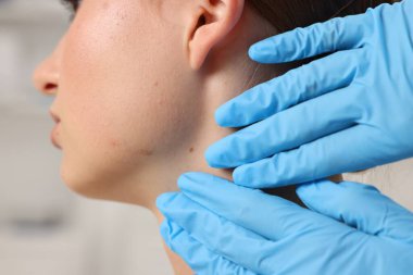 Hastanede genç bir kadının köstebeğini muayene eden doktor, yakın plan.