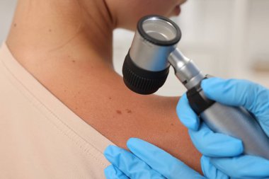 Doktor hastanede dermatoskopla genç kadının benini inceliyor.