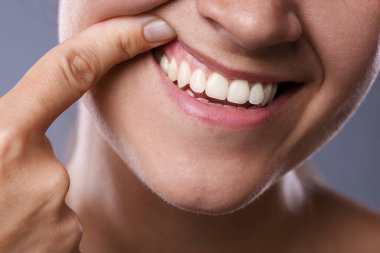 Gri arka planda dişlerini ve dişetlerini gösteren kadın, yakın plan.