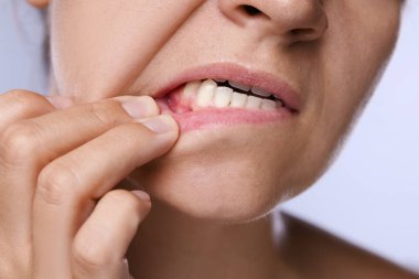 Dişlerini ve diş etlerini arka planda gösteren kadın, yakın plan.