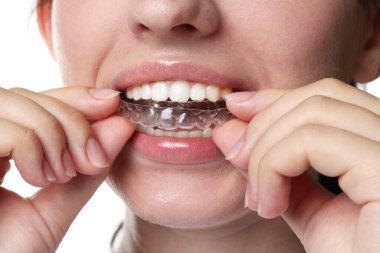 Beyaz arka planda diş hizalayan kadın, yakın plan.