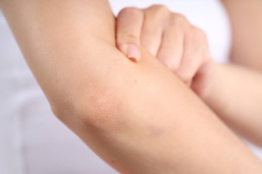 Normal ciltli bir kadının yakın görüntüsü