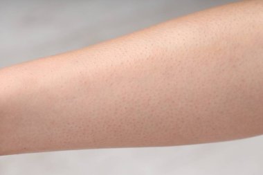 Bulanık arka planda normal cilde sahip bir kadın, yakın plan.