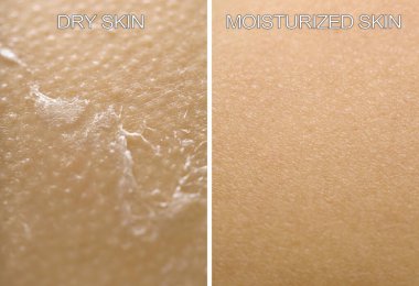 Bir tarafı kuru, diğer tarafı nemli, önce ve sonra kolaj.