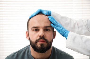 Kellik sorunu. Tıbbi eldivenli doktor klinikte hastanın kafasını muayene ediyor.