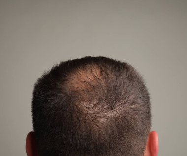 Gri arka planda kel bir adam var.