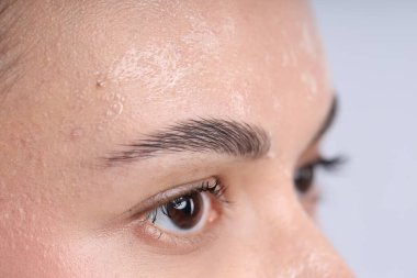 Yüzünde kuru deri olan bir kadın, açık arkaplanda, yakın plan.