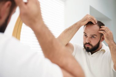 Kellik sorunu. Evinde aynanın yanında saçı dökülen bir adam var.