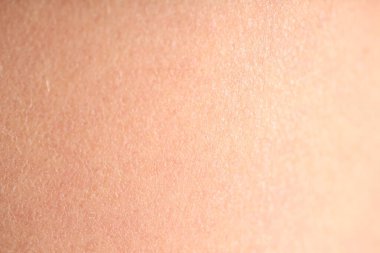 Arka plan olarak normal cilt dokusu, yakın plan