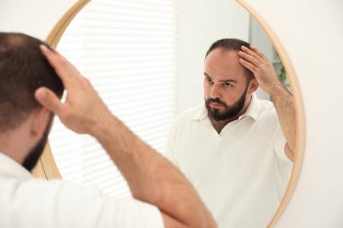 Kellik sorunu. Evinde aynanın yanında saçı dökülen bir adam var.