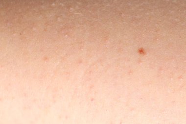 Arka plan olarak normal cilt dokusu, yakın plan