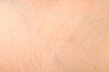 İnsan derisi, yakın çekim. Yüzeyin detaylı dokusu