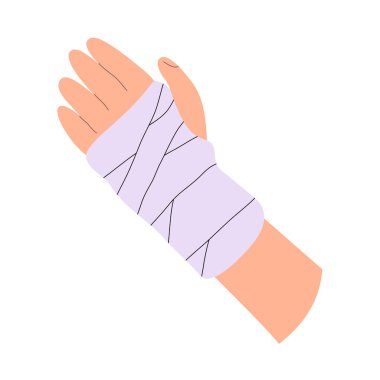 Illustration of plaster bondage on a broken arm