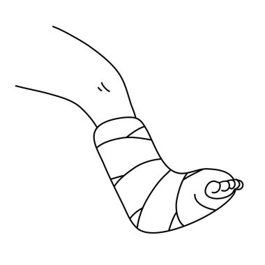 Bacak kırığı. Alçıtaşı bandajı. Tıbbi bakım, tedavi ve rehabilitasyon. Travma vakasına yardım. Düz vektör çizimi. Siyah ve beyaz taslak çizimi