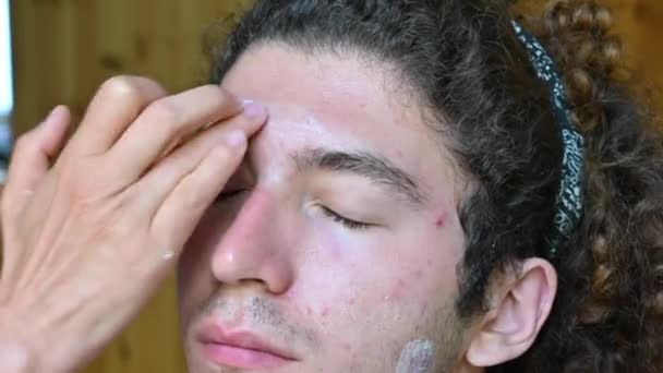 皮脂性皮膚炎に苦しんでいる若い白人男性の顔の肖像画 その上に抗生物質クリームの線量を持つ指は Sores Skinとボディケアに薄い層を広げる — ストック動画