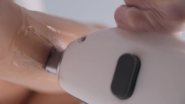 Laser Epilering Ett Hårborttagningsförfarande Kosmetolog Använder Laser För Att Avlägsna — Stockvideo