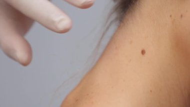 Dermatolog klinikte büyüteçle beni inceliyor..