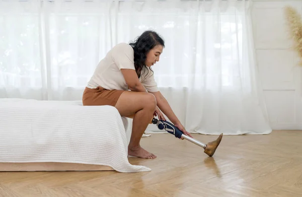 Asian woman disability with prosthetics bionic leg, prosthetic limbs sitting in bedroom at home.