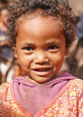 Behenjy, Madagaskar - 25 Nisan 2019: Kameraya bakan turistler tarafından bağışlanan kirli elbiseli küçük bir kız. Madagaskar 'daki insanlar, özellikle Malagasy' deki çocuklar fakir ama neşelidir. 