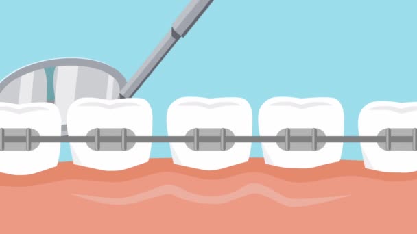 Dişçide Muayene Dişlerinde Diş Telleri Animasyon Yüksek Kaliteli Fullhd Görüntüler — Stok video