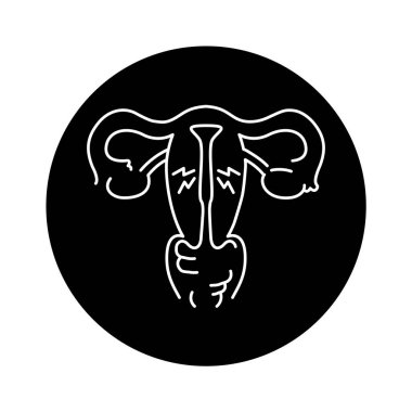 Endometrial hyperplasia color line icon. Gynecology problem