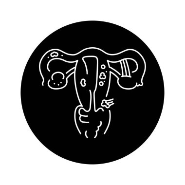 Endometriosis color line icon. Gynecology problem