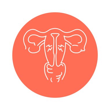 Endometrial hyperplasia color line icon. Gynecology problem