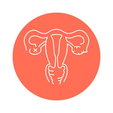 Uterine myoma color line icon. Gynecology problem