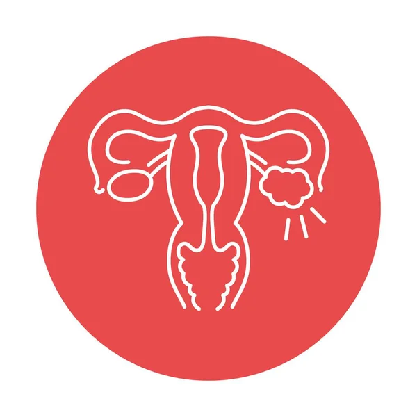 Polycystic Ovary Syndrome Line Color Icon Female Reproductive System Disease — Stock Vector