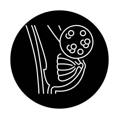 Mastitis renk çizgisi simgesi. İnsan hastalıkları. 