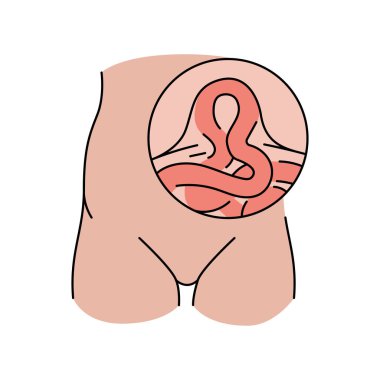 Epigastrik fıtık çizgisi ikonu. Vektör izole ögesi.