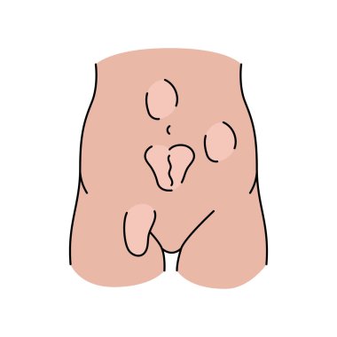 Fıtık çizgisi simgesi. Vektör izole ögesi.