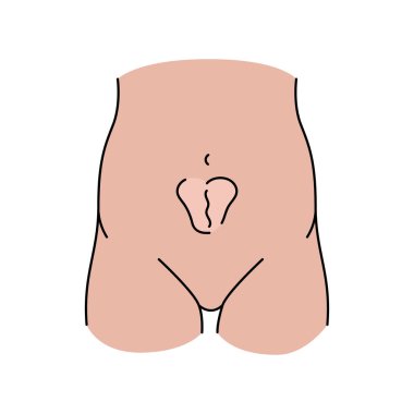 İnsiyonel fıtık çizgisi ikonu. Vektör izole ögesi.