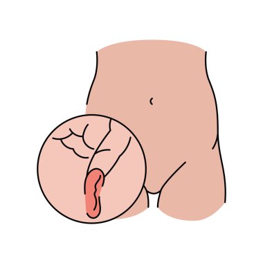 İnguinal fıtık çizgisi ikonu. Vektör izole ögesi.