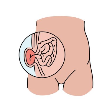 Boğulmuş fıtık çizgisi ikonu. Vektör izole ögesi.