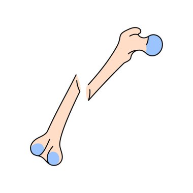 Belirsiz yer değiştirilmiş kemik kırılma çizgisi simgesi. 