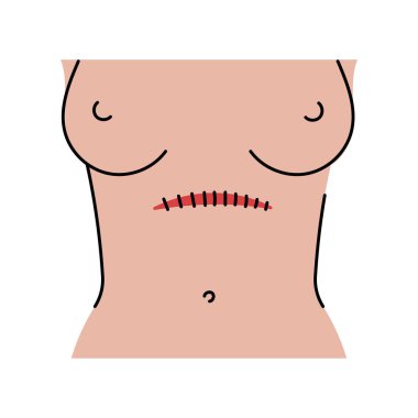 Enine kesme çizgisi simgesi. Karın kesikleri. 