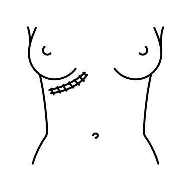 Kocher kesik çizgisi simgesi. Karın kesikleri. 