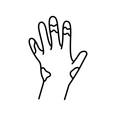 Skleroderma renk çizgisi simgesi. Otoimmün hastalıklar. 