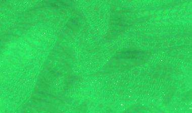 Akan, parıldayan dokuları olan yeşil dantelli bulanık kumaş. Karmaşık, şeffaf desenler, canlı yeşil tonlarla güçlendirilmiş yumuşak ve zarif bir görünüm yaratıyor..