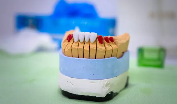 appliance for designing ceramic teeth, medical concept, dental clinic, stock photo