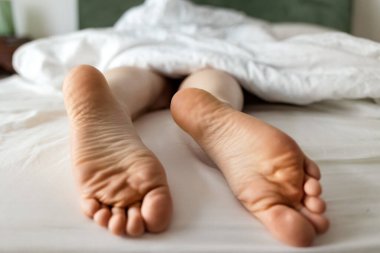 Person's legs sticking out under blanket. Barefeet close-up with dry calluses and corns.